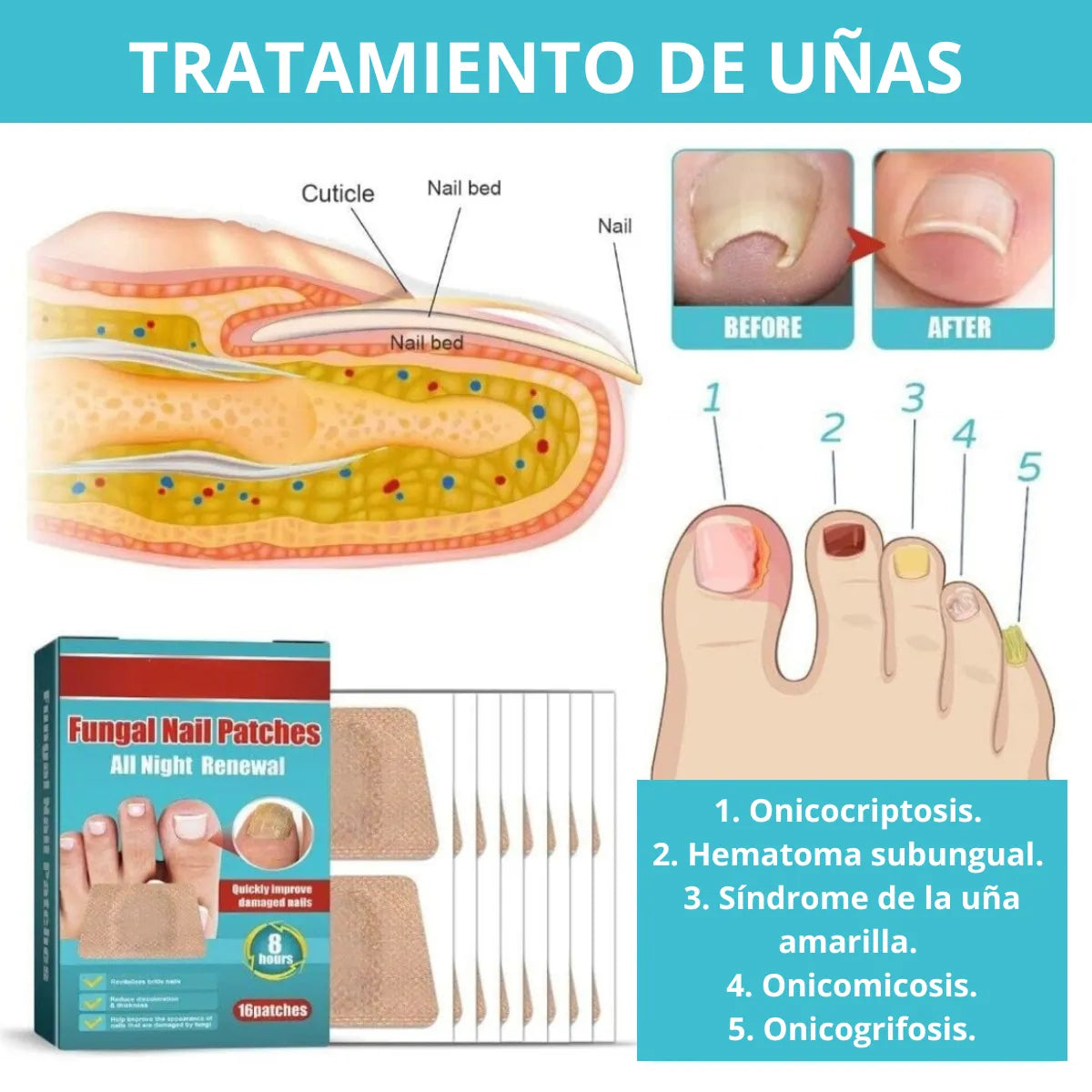 Kit Intensivo Anti Hongos - Dia Y Noche