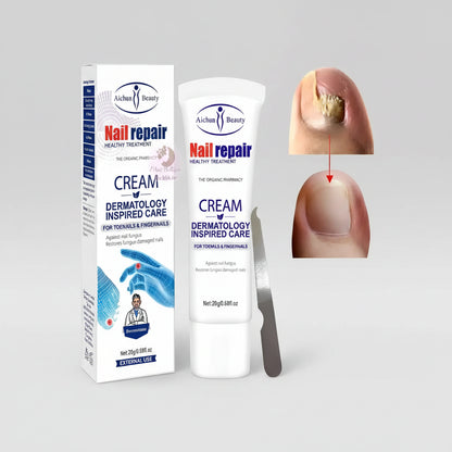 ✨ NailCure Pro – Crema Reparadora de Uñas con Hongos